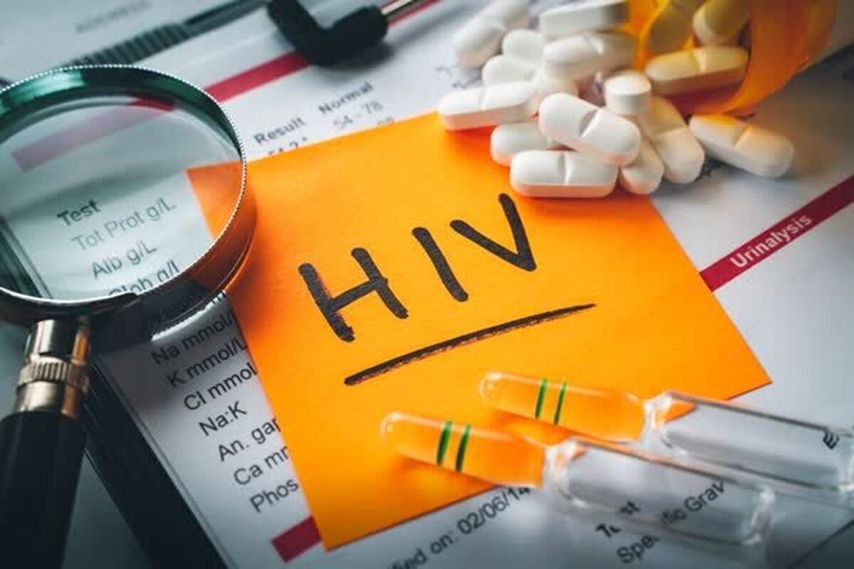 خبر خوش برای مبتلایان به اچ‌آی‌وی
